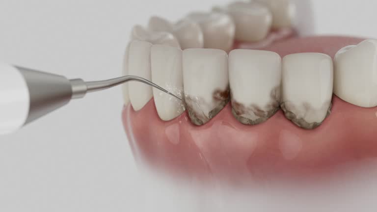 Reliable Teeth Cleaning And Checkup contractor in Webster County County, WV by Dentist Open Now